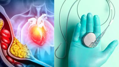 হার্টব্লক কী? কখন এবং কেন জরুরি পেসমেকার?