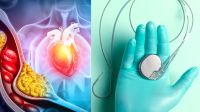হার্টব্লক কী? কখন এবং কেন জরুরি পেসমেকার?
