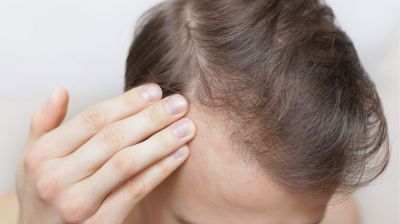 শীতকালে কোন ভুলে চুলের সমস্যা বাড়ে