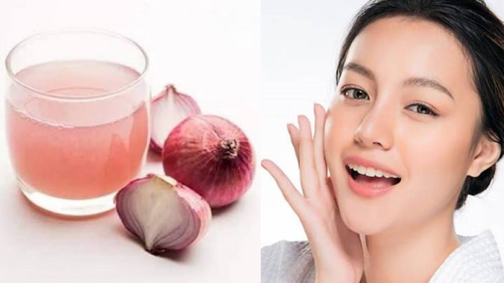 পেঁয়াজের গুণেই বাড়বে ত্বকের স্নিগ্ধতা, যেভাবে মাখলে দূর হবে বলিরেখা