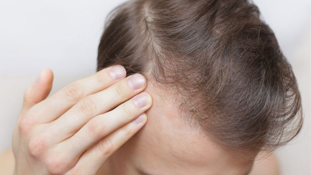 শীতকালে কোন ভুলে চুলের সমস্যা বাড়ে