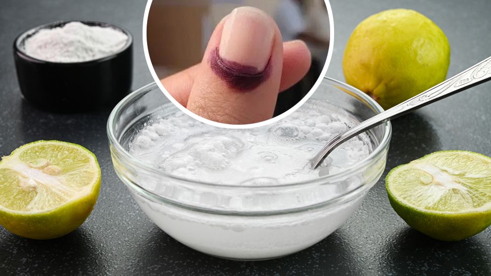 আঙুলের কালির দাগ তুলবেন যেভাবে