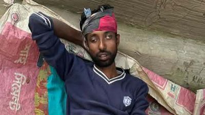 মাছ চুরির অপবাদ দিয়ে যুবকের পা ভেঙে দিলেন প্রজেক্ট মালিক