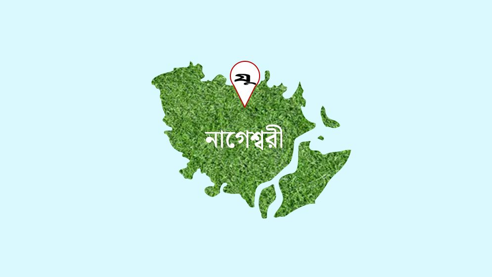 মাথার খুলিবিহীন অস্বাভাবিক আকৃতির শিশুর জন্ম