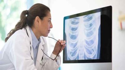 এবার ফুসফুস ক্যানসার শনাক্তে এআই