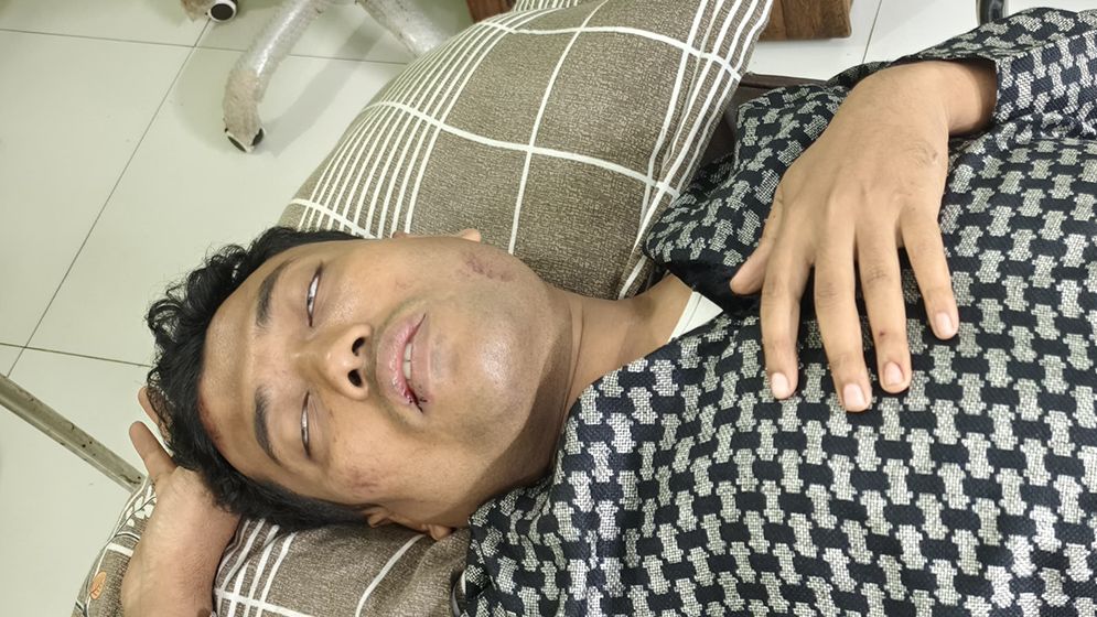 যুবকের রগ কাটলেন বহিষ্কৃত যুবদল নেতা