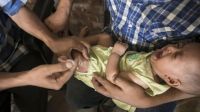 শিশুদের মধ্যে হঠাৎ হামের প্রকোপ বাড়ার কারণ কী?