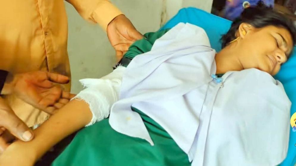 এসএসসি পরীক্ষার্থীর হাত ভেঙে দিলেন চাচা