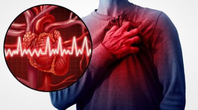 যে রক্তের গ্রুপে স্ট্রোকের ঝুঁকি বেশি