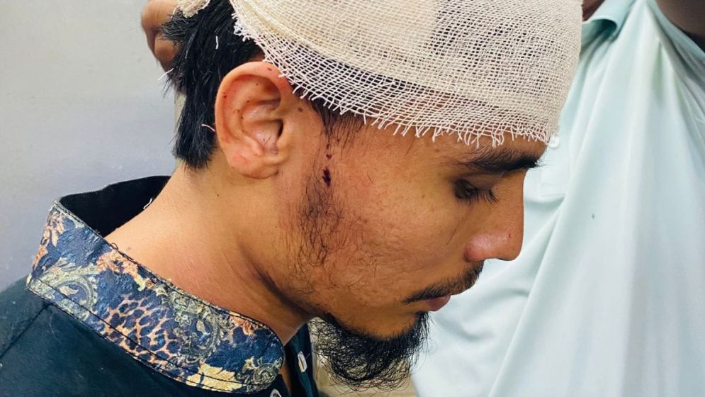উত্ত্যক্ত করার প্রতিবাদ করায় কলেজছাত্রের ওপর হামলা