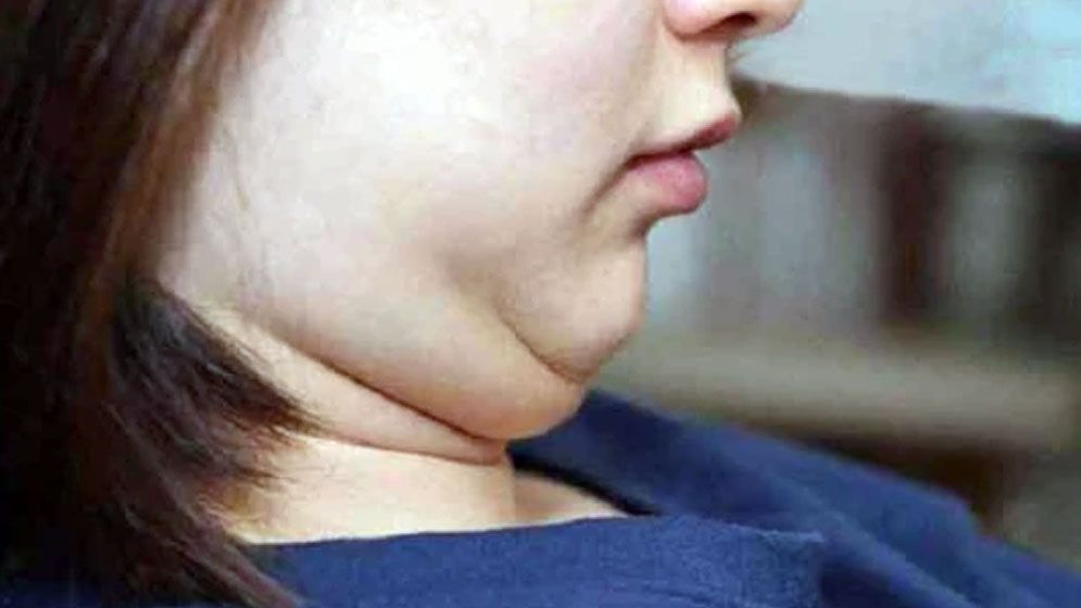 গাল ফুলছে? সতর্ক হোন এখনই