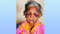 নির্যাতনের শিকার বাকপ্রতিবন্ধী সেই অসহায় বুবি আর নেই