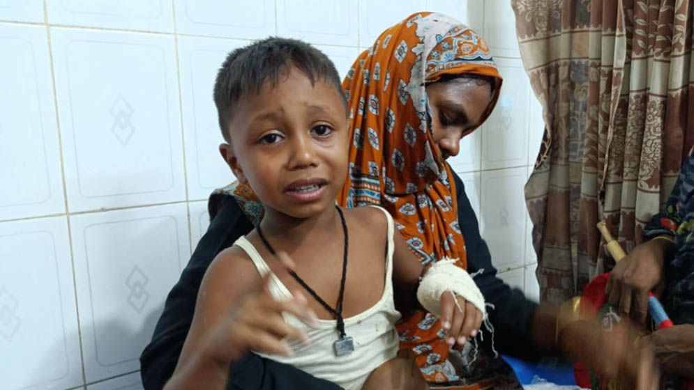 কুকুরের কামড়ে শিশুর হাতের বুড়ো আঙুল বিচ্ছিন্ন