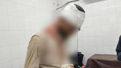 ফের জকসু নেতার ওপর হামলা