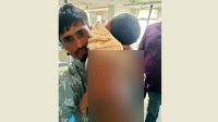 আগুনে দগ্ধ শিশুর চিকিৎসার দায়িত্ব নিলেন ভারপ্রাপ্ত স্পিকার