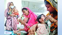 হাম ও উপসর্গে মৃত্যু হাজার ছাড়াল