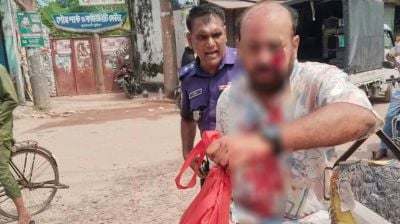 সাংবাদিকের ওপর এমপির ভাইয়ের হামলা