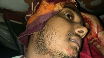 এনসিপি নেতাকে কুপিয়ে জখম