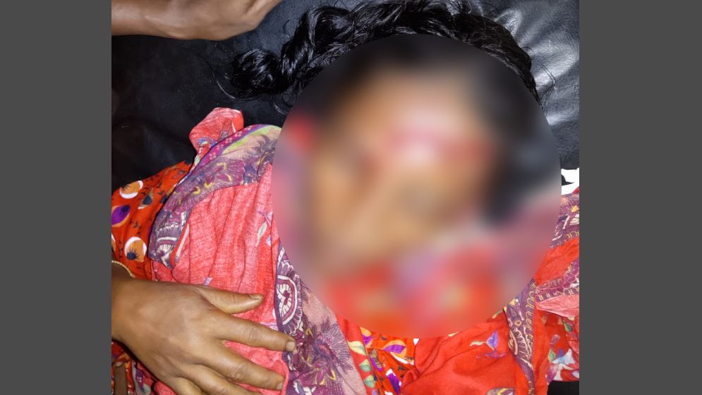 সুন্দরগঞ্জে শেয়ালের আক্রমণে আহত ৯