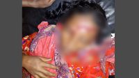 সুন্দরগঞ্জে শেয়ালের আক্রমণে আহত ৯