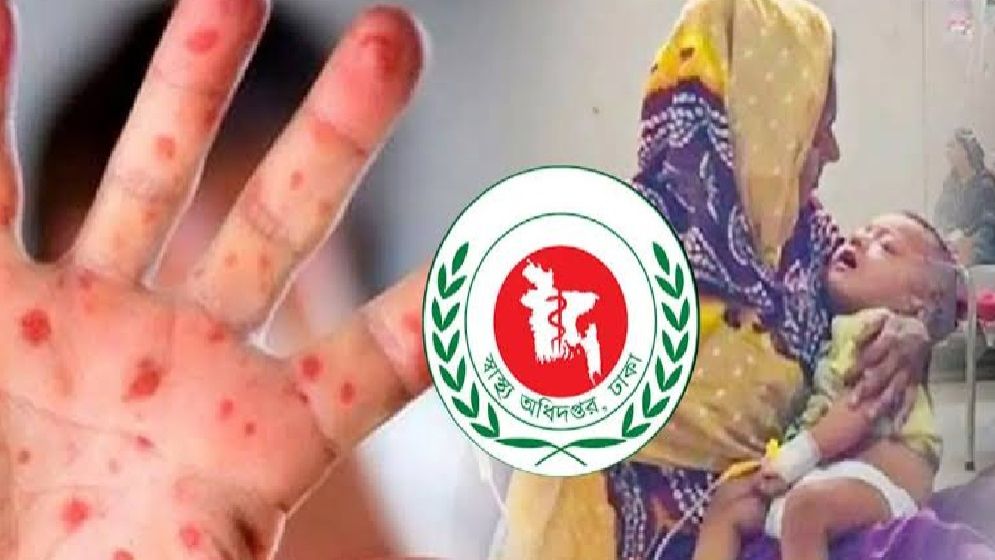 হামে প্রাণ হারাল আরও ২ শিশু