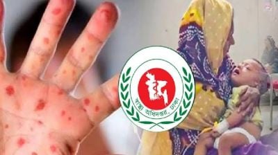 হামে প্রাণ হারাল আরও ২ শিশু