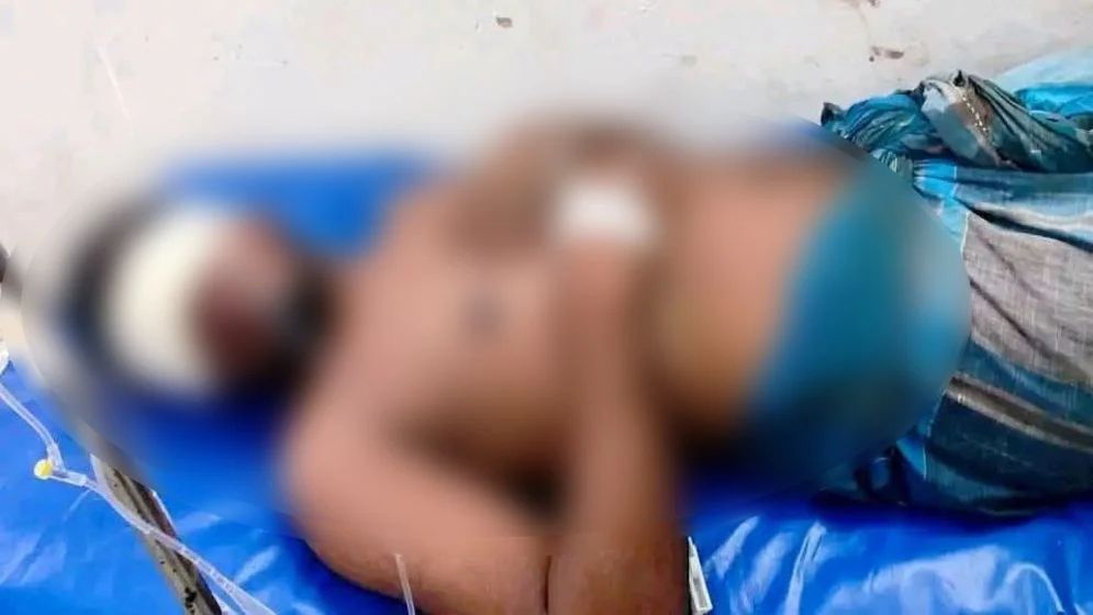 মাইক্রোবাসে তুলে উপড়ে ফেলা হলো যুবকের দুই চোখ