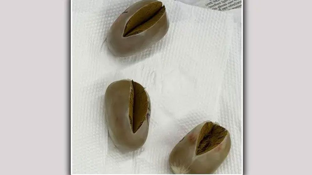 পায়ুপথে আমিরাত থেকে বয়ে আনল ৩ সোনার ডিম