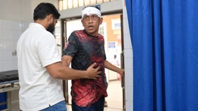 অভিনেতা সমু চৌধুরীর মাথা ফাটাল দুর্বৃত্তরা