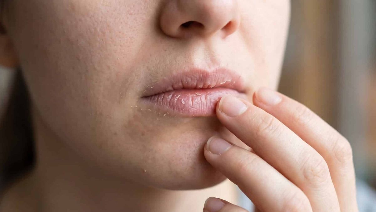 শীত আসার আগেই ঠোঁট ফাটছে? ঘরোয়া সমাধান জানুন