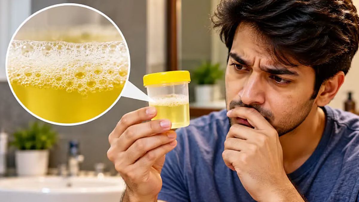 প্রস্রাবে অতিরিক্ত ফেনা কিডনির সমস্যা নাতো